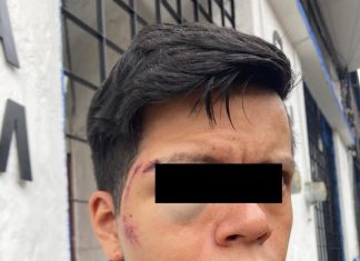 Trabajadores de Limpia Publica del ayuntamiento de Xalapa golpean a un hombre por defender a su esposa.